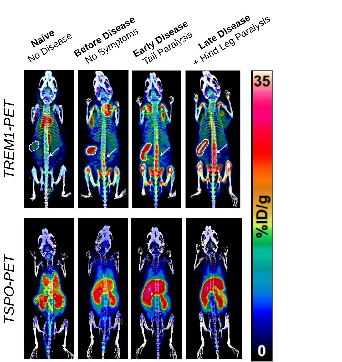 TREM1-PET (top row, Willow's tracer) vs TSPO-PET (bottom row, current gold-standard) imaging across Naïve → Late Disease mouse states